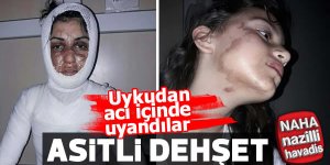 Uyuyan hala ve yeğenine asitli saldırı